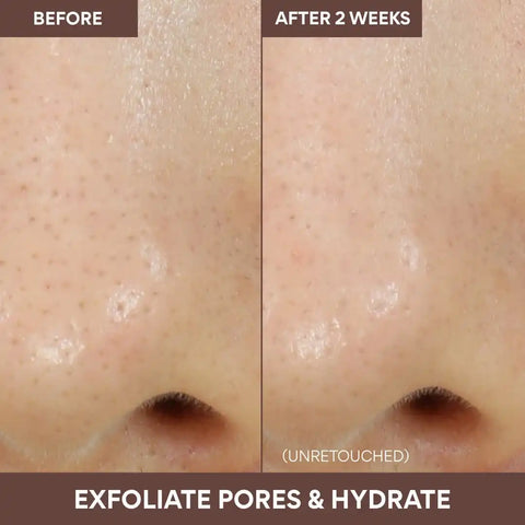 Volcanic Swirl Pore Mask