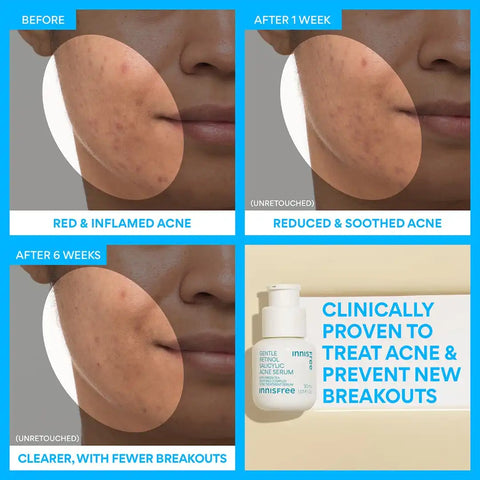 The Smooth Skin Kit