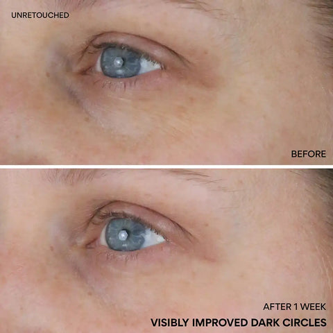 Vitamin C Niacinamide Brightening Eye Serum