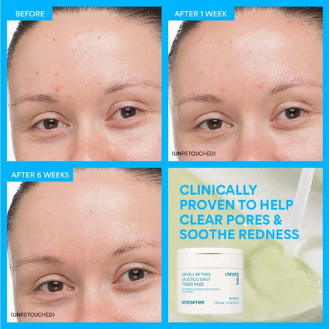 The Smooth Skin Kit