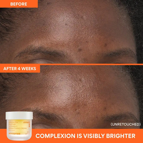 The Dewy Skin Kit