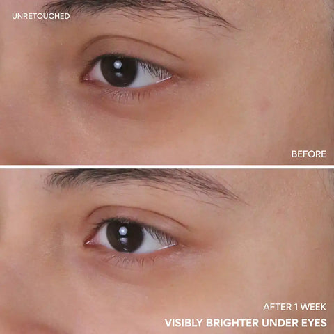Vitamin C Niacinamide Brightening Eye Serum